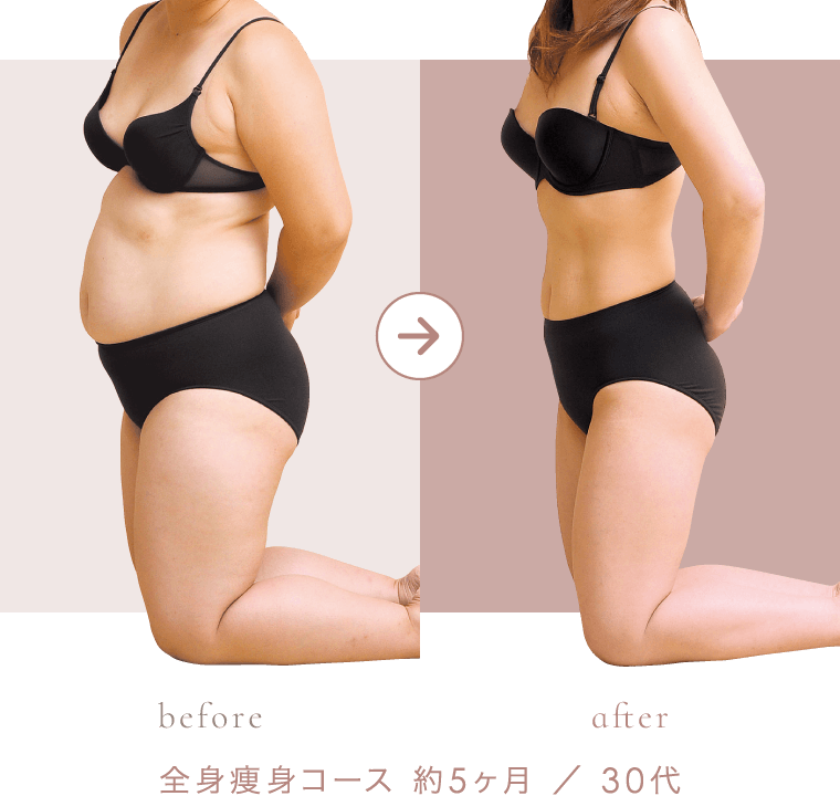 全身痩身コース 約5ヶ月 ／ 30代 のビフォーアフター